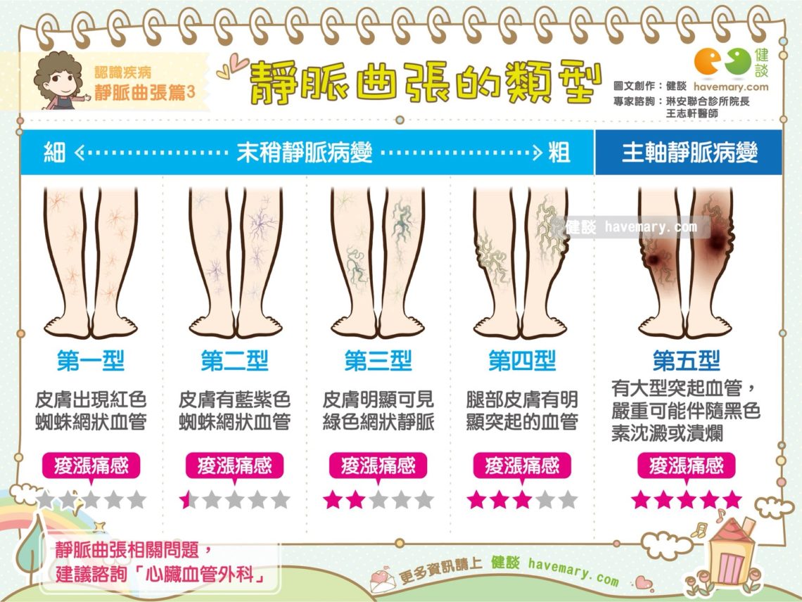 靜脈曲張症狀、併發症與急症