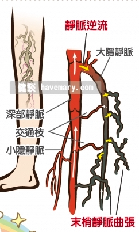 標示穿靜脈的位置
