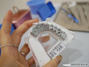 蛀牙不必做牙套-3D齒雕還你健康牙齒