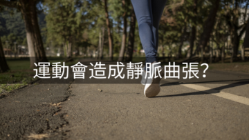 運動會造成靜脈曲張?